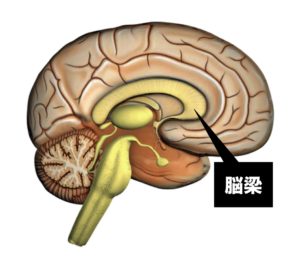 brain2